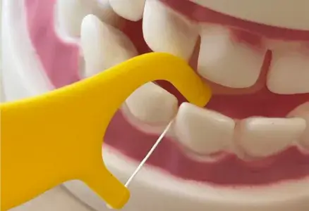 Can a Water Flosser Replace Traditional Dental Floss? The Truth You Need to Know